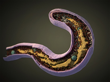 Bdellovibrio