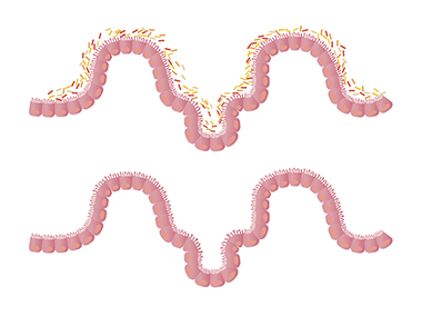 Gut with or without flora