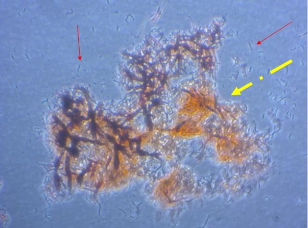 6913_amyloid1_176116.jpg