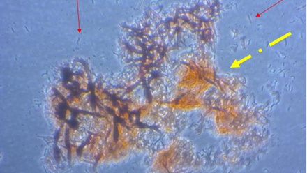 6913_amyloid1_176116.jpg