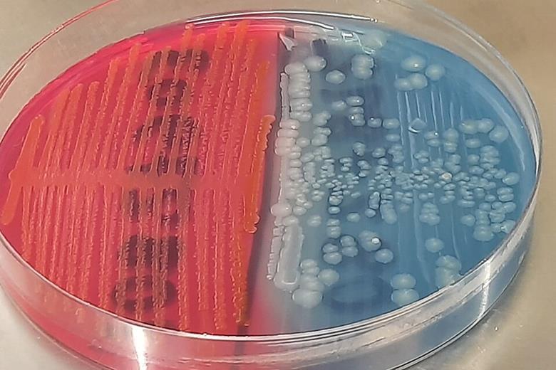 19707_lactosefermenting_lf_strain_and_nonlactose_fermentingnlf_strain_of_e._coli_colony_morphology_on_cled_medium_983074_crop.jpg