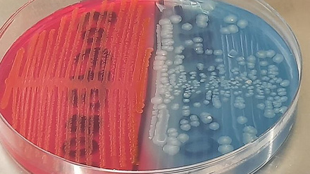 19707_lactosefermenting_lf_strain_and_nonlactose_fermentingnlf_strain_of_e._coli_colony_morphology_on_cled_medium_983074_crop.jpg