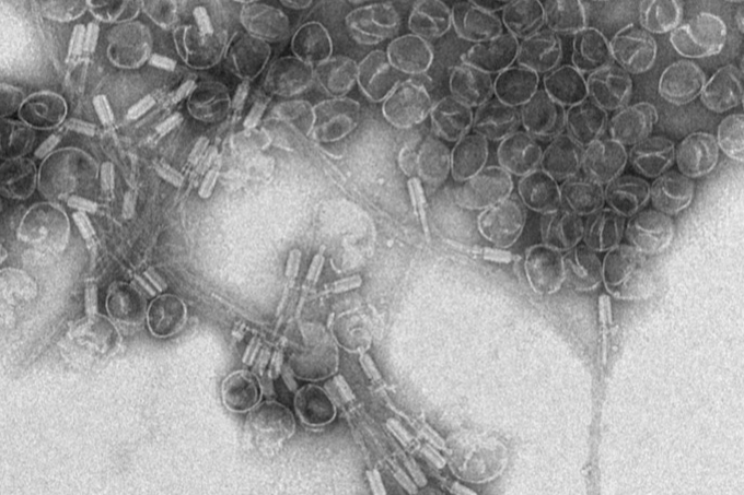 20120_bacillus_180020_crop.png