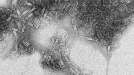 20120_bacillus_180020_crop.png