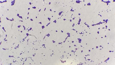 7134_staphgramstain1_190874_crop.jpg