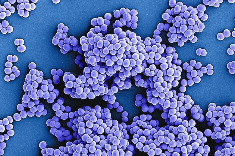 6297_nationalinstituteofallergyandinfectiousdiseasesbtrsvamnnw0unsplash1_489612_crop.jpg