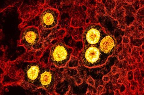 6873_novel_coronavirus_sarscov2_omicron_52241171666_49633_crop (1).jpg