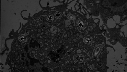 5293_thumbnail_basporesinamurinemacrophage_632955_crop (1).jpg