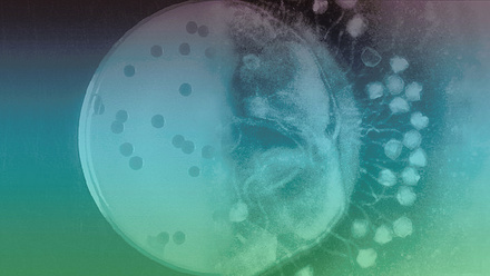Bacteriophages_at_work_colour.jpg