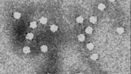 canines_parvovirus_946173_crop.jpg