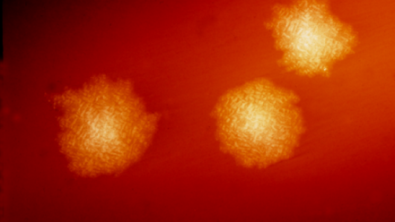 9271_clostridium_difficile_colonies_21628 (1).png