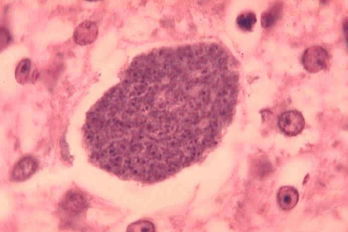 16721_histopathology_of_malaria_exoerythrocytic_forms_in_liver_07g0024_lores_241924_crop.jpg