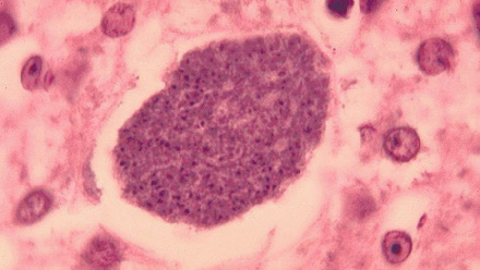 16721_histopathology_of_malaria_exoerythrocytic_forms_in_liver_07g0024_lores_241924_crop.jpg