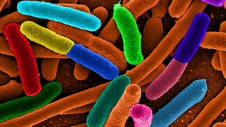E coli coloured.png